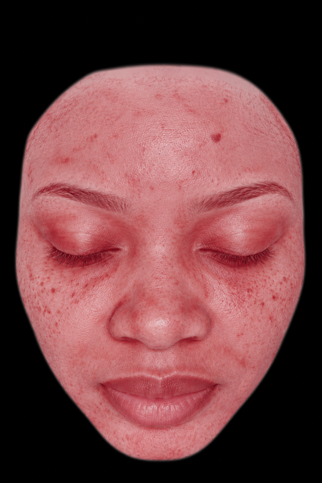 Illustration d'analyse cutanée en composite rougeurs